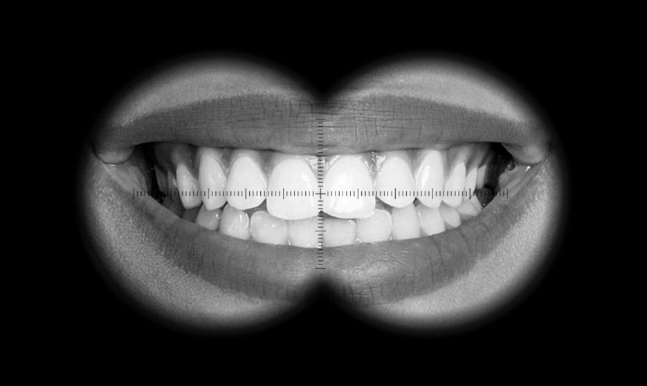 3.8x Magnification Scope Image Showing Teeth.