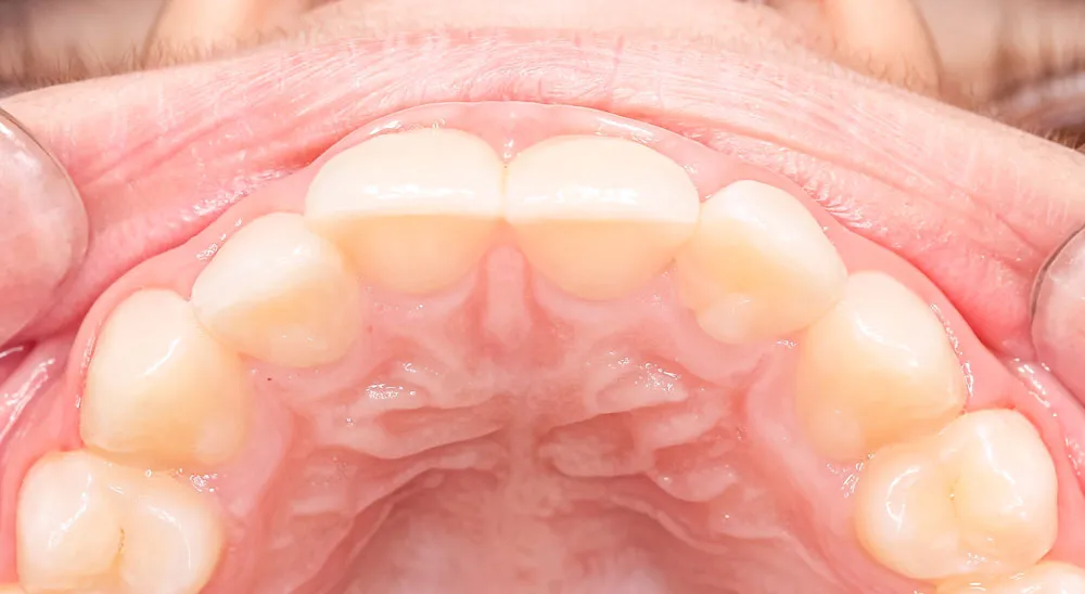 Teeth magnification 3