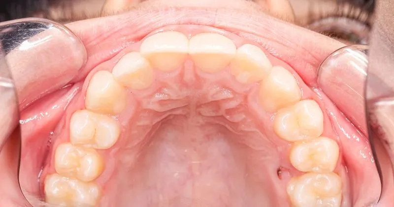 Teeth magnification 2